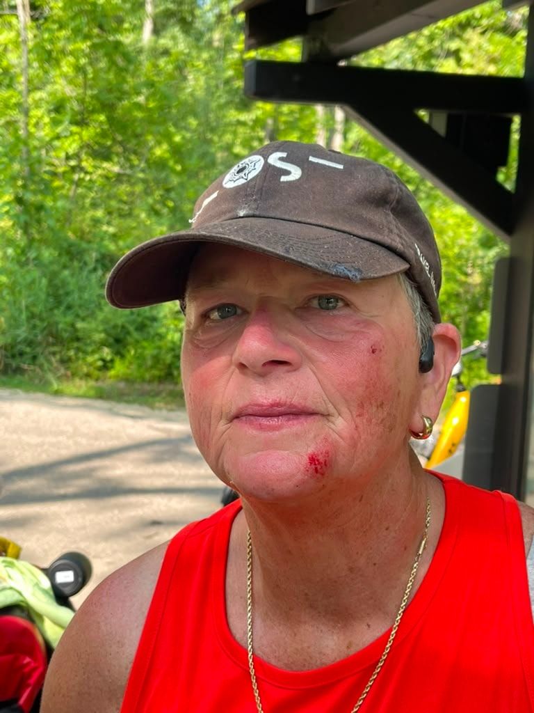 Close portrait of a rider in a red vest and cap with a scrape on her chin